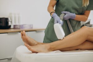 epilation-depilation-laser